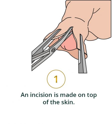 step-1