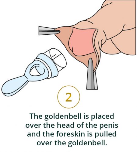 step-2