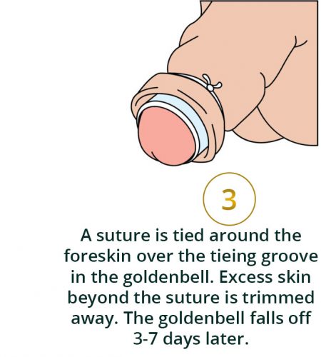 step-3
